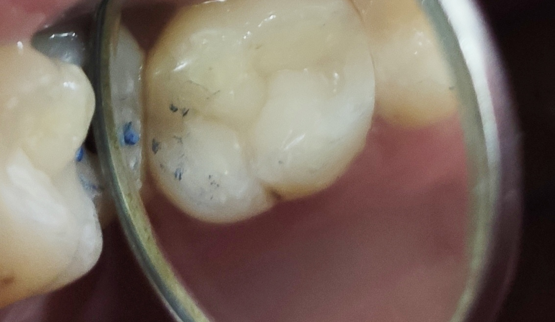 Konzervativna stomatologija i endodoncija