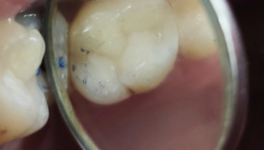 Konzervativna stomatologija i endodoncija